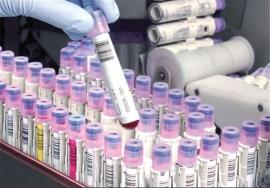 ذخیره‌سازی بیش از ۳۰۰ سلول بنیادین خون بندناف در بوشهر 