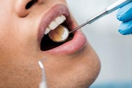 دندانپزشکان آمریکا: کرونا به دندان‌ها هم آسیب می زند