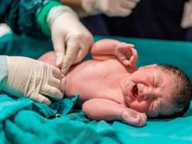 بروز مشکل تنفسی در نوزادان سزارينی بيشتر از طبیعی است